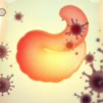 Flick International Close-up illustration of a highlighted human appendix with cancer cells surrounding it
